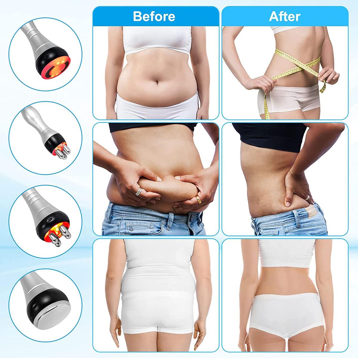 TILLO™ Body Renovating Massager